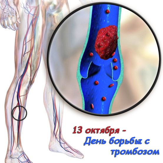 11-Mezhdunarodnyj-den-borby-s-trombozom.jpg